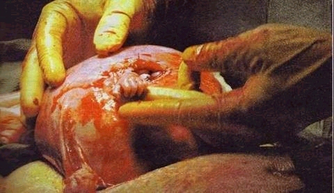 Picure of doctor holding Baby Samuel's hand